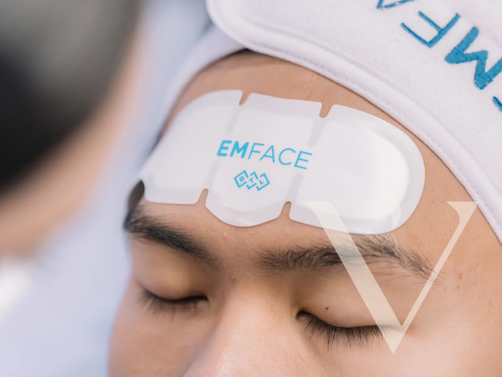 Close-up of an EMFACE applicator pad on a client's forehead at CANVAS Medical Clinic, Penang