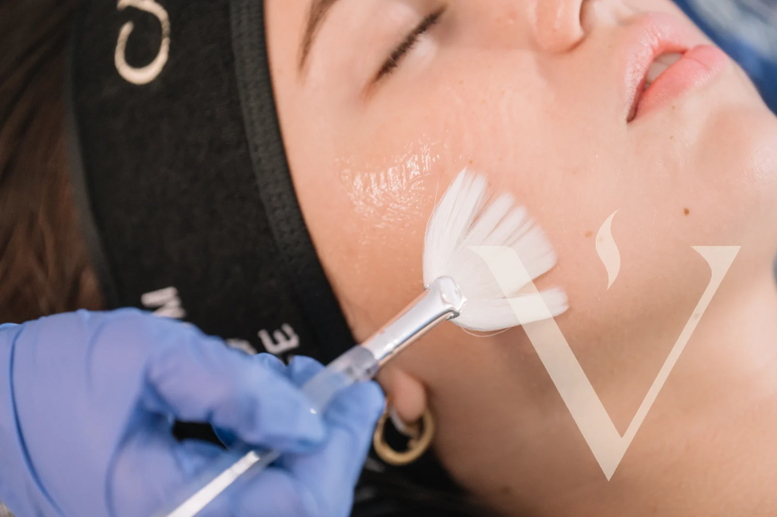 Close-up of a brush-applied facial treatment at CANVAS Medical Clinic, Penang