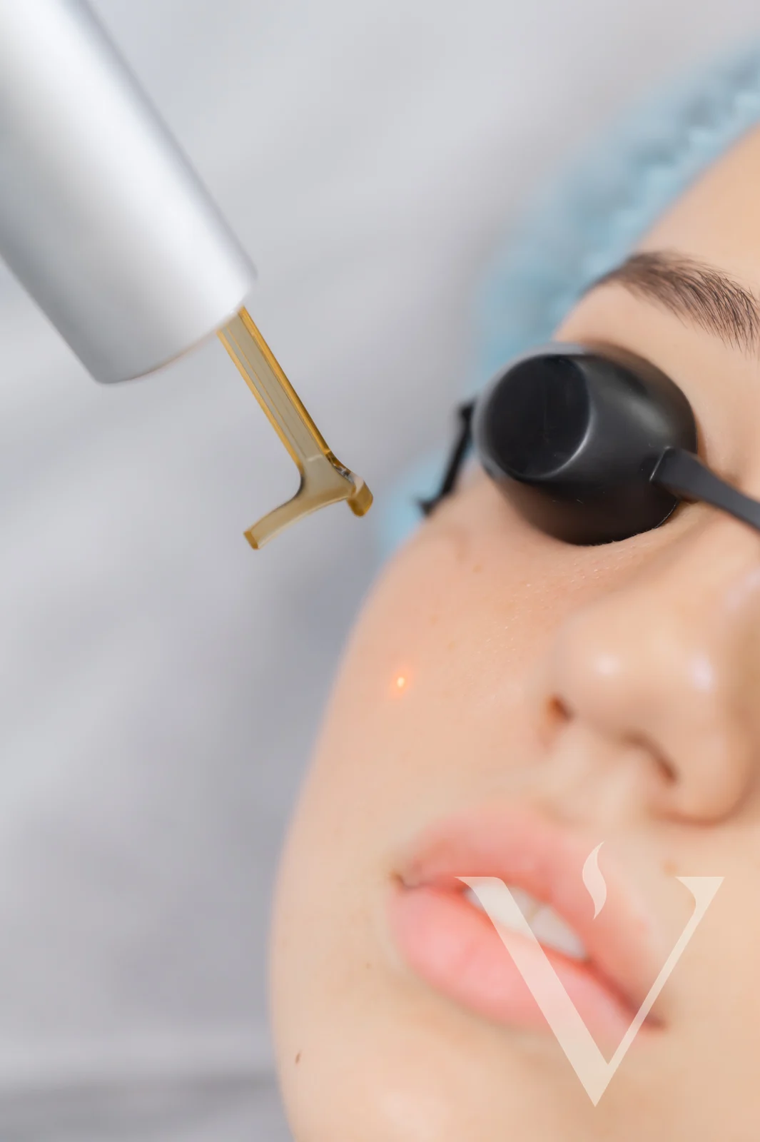 Close-up of a laser device treating a client's cheek at CANVAS Medical Clinic, Penang